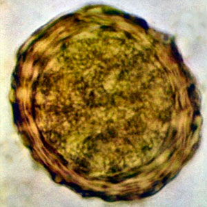 Oeuf d'Ascaris spp. embryonné