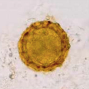 Oeuf d'Ascaris spp.embryonné