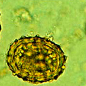 Oeuf d'Ascaris spp. embryonné