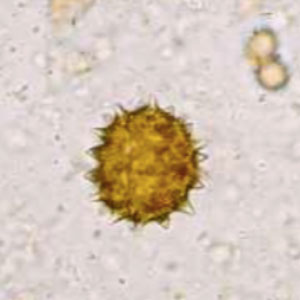 Pollen de chardon (Cirisium arvense)