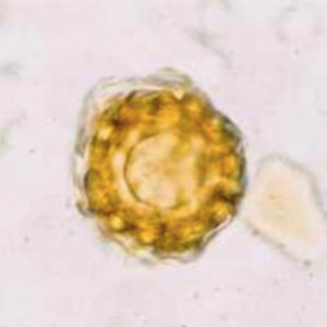 Spore de mildiou du pois (Peronospora pisi)