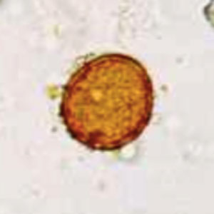 Spore de rouille d'oseille (Uredo bifrons)