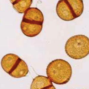 Spore de rouille du pissenlit (Puccinia variabilis)