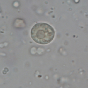 Kyste d'Entamoeba hartmanni