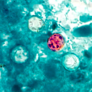 Oocyste de Cyclospora spp. visualisé après coloration au Ziehl-Neelsen modifiée (certains oocystes ne prennent pas la coloration)
