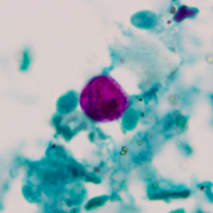 Oocyste de Cyclospora spp. visualisé après coloration au Ziehl-Neelsen modifiée