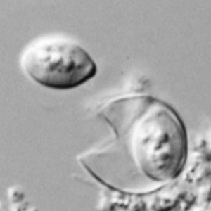 Oocyste de Cyclospora spp. visualisé au microscopie à contraste interférentiel
