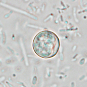 Oocyste de Cyclospora spp. visualisé sans coloration