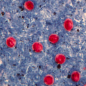 Oocystes de Cryptosporidium spp. colorés par la coloration de Ziehl-Neelsen modifiée