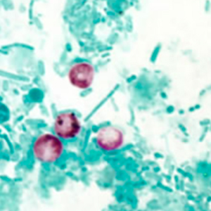 Oocystes de Cryptosporidium spp. colorés par la coloration de Ziehl-Neelsen modifiée