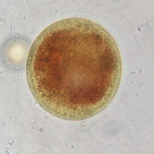 Kyste de Balantidium coli coloré au lugol
