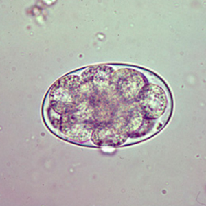 Œuf d'Oesophagostomum spp.