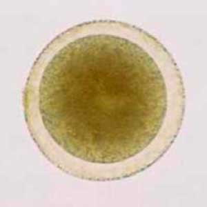 Pollen de crocus printanier (Crocus albiflorus) (Petithory et al., 1995)
