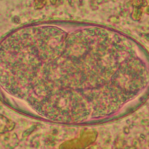 Ancylostoma spp. egg
