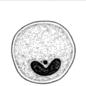 Balantidium coli cyst (Garcia, 2009)