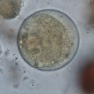 Balantidium coli cyst stained with Lugol