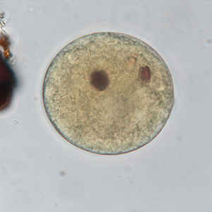 Balantidium coli cyst stained with Lugol