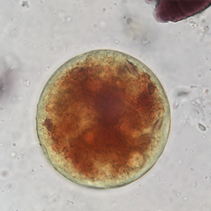 Balantidium coli cyst stained with Lugol