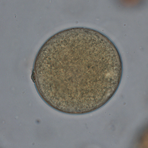 Balantidium coli cyst stained with Lugol