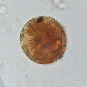 Balantidium coli cyst stained with Lugol