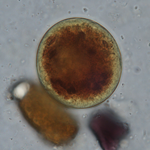 Balantidium coli cyst stained with Lugol