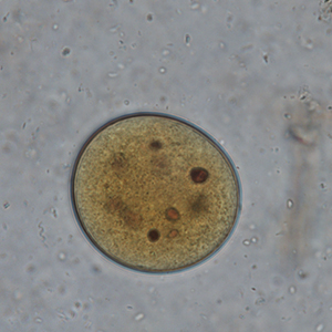 Balantidium coli cyst stained with Lugol