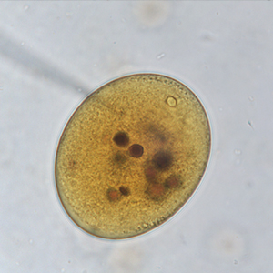 Balantidium coli cyst stained with Lugol