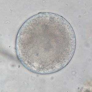 Balantidium coli cyst