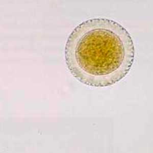 Bay laurel seed (Laurus nobilis) (Petithory et al, 1995)