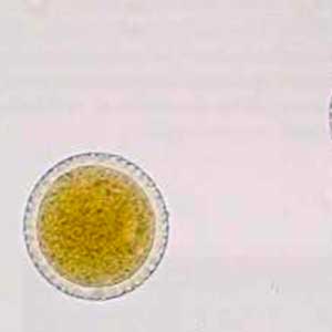 Bay laurel seed (Laurus nobilis) (Petithory et al, 1995)