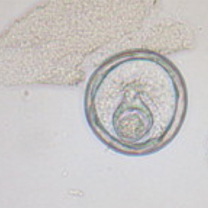 Bertiella spp. egg (Gómez -Puerta et al., 2009)