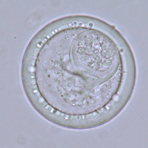 Bertiella spp. egg