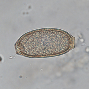 Capillariidae egg in a Siamang