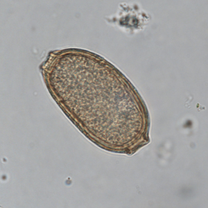 Capillariidae egg in a Siamang