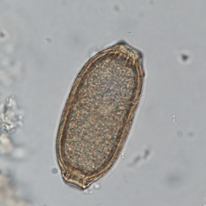 Capillariidae egg in a Siamang