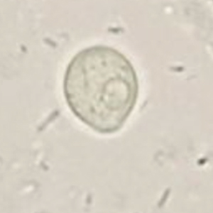 Chilomastix mesnili cyst