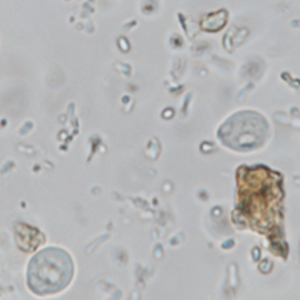 Chilomastix mesnili cyst (x100)