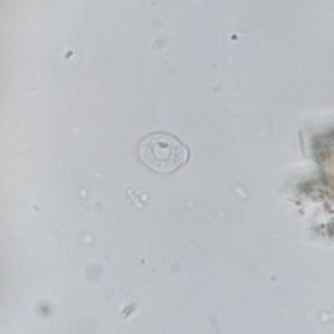 Chilomastix mesnili cyst (x100)