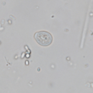 Chilomastix mesnili cyst (x100)