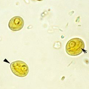 Chilomastix mesnili cyst