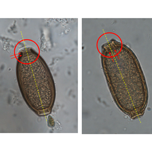 Comparison between a capillariidae egg (right) and trichurid egg (left), based on the orientation of the ridges of the insertion site of their polar plugs