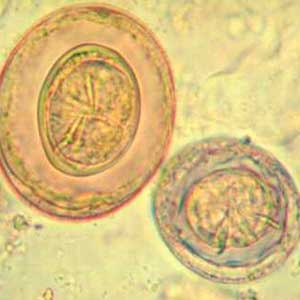 Comparison between a barley pollen seed (Hordeum vulgare, left) and an egg from Hymenolepis nana (right) (Petithory et al, 1995)