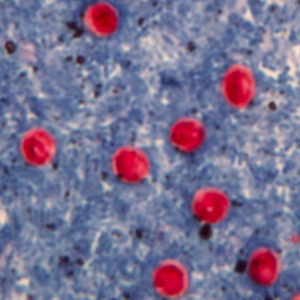 Cryptosporidium spp. oocysts stained with modified Ziehl Neelsen
