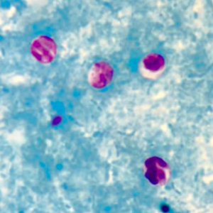 Cryptosporidium spp. oocysts stained with modified Ziehl Neelsen