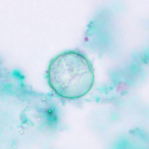 Cyclospora spp. oocyst stained with trichrome stain