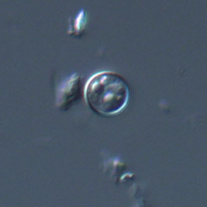 Cyclospora spp. oocyst visualized under differential contrast microscopy