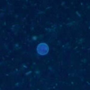 Cyclospora spp. oocyst visualized under fluorescence microscopy