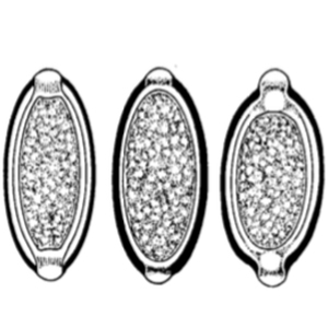 Different morphologies of whipworm eggs (Garcia, 2021)