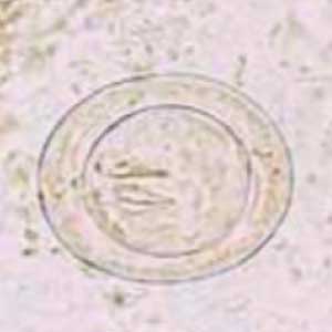 Egg from Hymenolepis nana (Petithory et al, 1995)