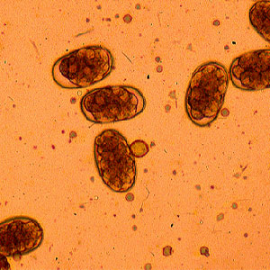 Eggs from Ancylostoma and Necator spp
